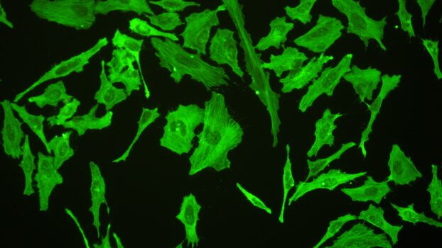 PROMICAM HDMI 16 - fluorescence