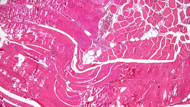 PROMICAM HDMI 16 - tissue section