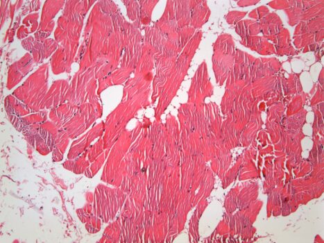 PROMICAM PRO L5 - tissue section